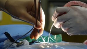 neurosurgeon operating with technology